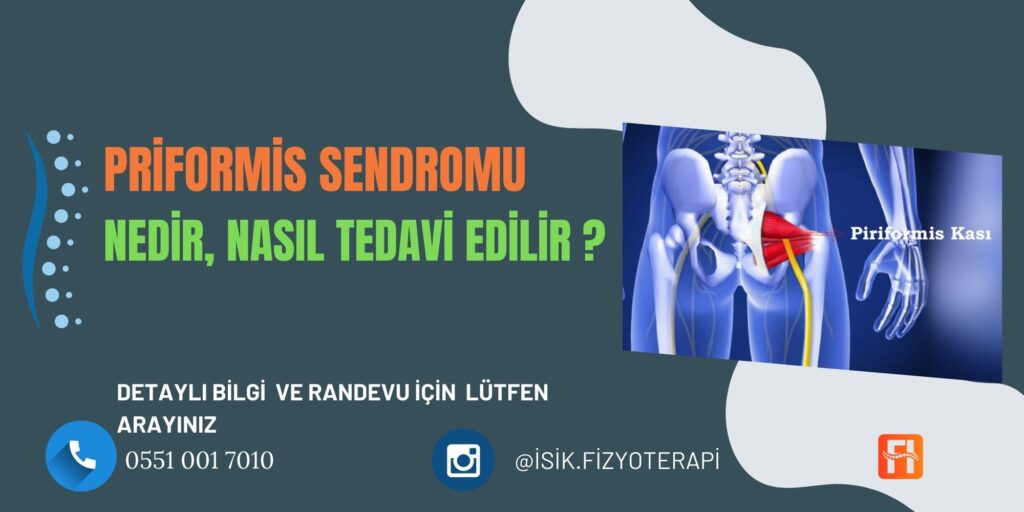 Priformis Sendromu